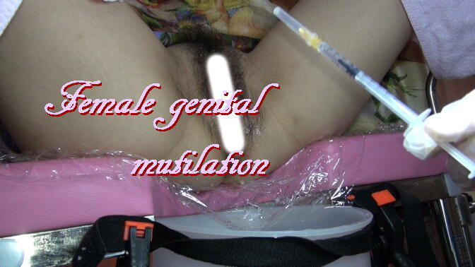 1Female genital mutilation